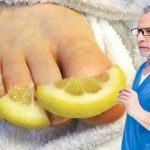 U POTPUNOSTI UNIŠTITE GLJIVICE NA NOKTIMA: 10 najboljih narodnih načina za borbu protiv gljivica U POTPUNOSTI UNIŠTITE GLJIVICE NA NOKTIMA: 10 najboljih narodnih načina za borbu protiv gljivica - featured image