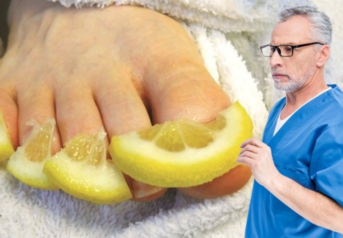 U POTPUNOSTI UNIŠTITE GLJIVICE NA NOKTIMA: 10 najboljih narodnih načina za borbu protiv gljivica - featured image U POTPUNOSTI UNIŠTITE GLJIVICE NA NOKTIMA: 10 najboljih narodnih načina za borbu protiv gljivica - featured image