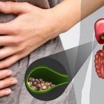 ŽUČNI KAMENAC MOŽETE IZBACITI I KROZ STOLICU – A EVO KAKO ĆETE TO USPJETI ŽUČNI KAMENAC MOŽETE IZBACITI I KROZ STOLICU – A EVO KAKO ĆETE TO USPJETI - featured image