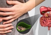 ŽUČNI KAMENAC MOŽETE IZBACITI I KROZ STOLICU – A EVO KAKO ĆETE TO USPJETI ŽUČNI KAMENAC MOŽETE IZBACITI I KROZ STOLICU – A EVO KAKO ĆETE TO USPJETI - featured image