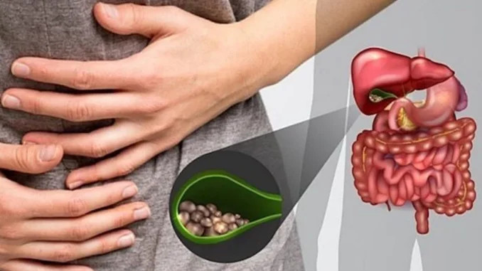 ŽUČNI KAMENAC MOŽETE IZBACITI I KROZ STOLICU – A EVO KAKO ĆETE TO USPJETI - featured image ŽUČNI KAMENAC MOŽETE IZBACITI I KROZ STOLICU – A EVO KAKO ĆETE TO USPJETI - featured image